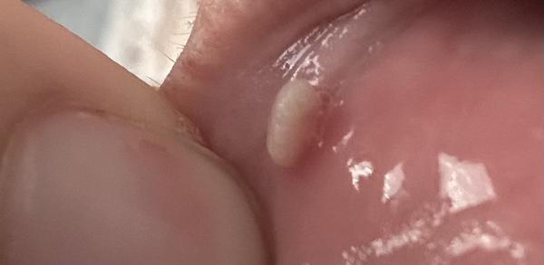 Čo to mám na pere?