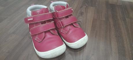 Protetika prechodné barefooot topánočky, protetika,25