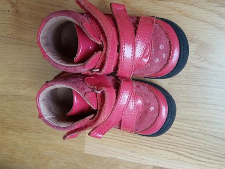 Topánočky barefoot protetika, protetika,22