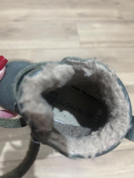 Protetika zimna obuv, protetika,23