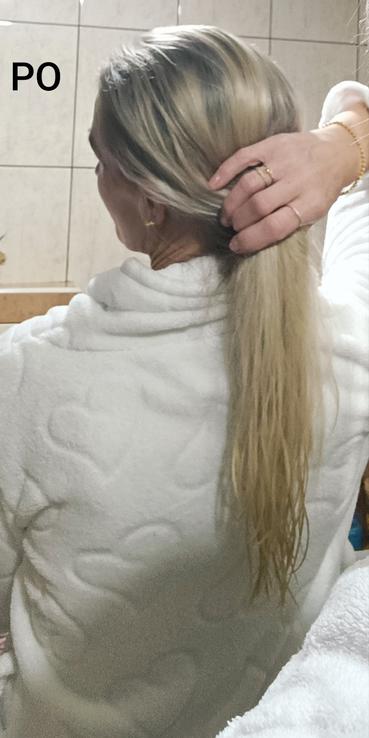 Balzam proti vypadávaniu vlasov L’Oréal Paris Elseve Growth Booster