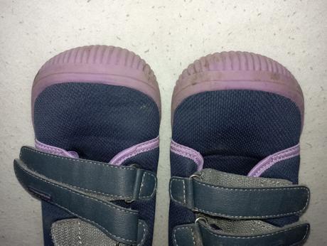 Tenisky, protetika,33