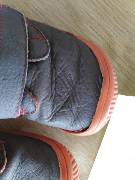 Kožené topánky protetika barefoot, protetika,31