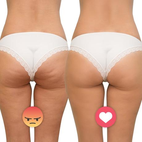 Ultrasonický masážny prístroj insportline valeri, 