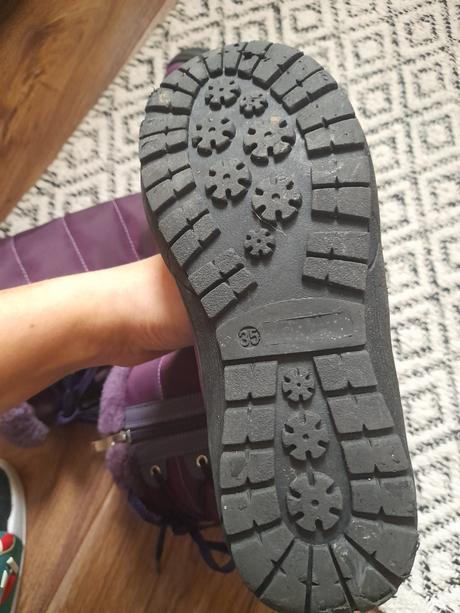 Cizmicky protetika, protetika,35