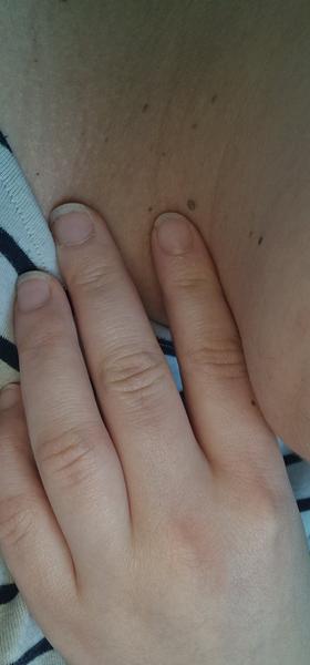 Čo sú to za výrastky?