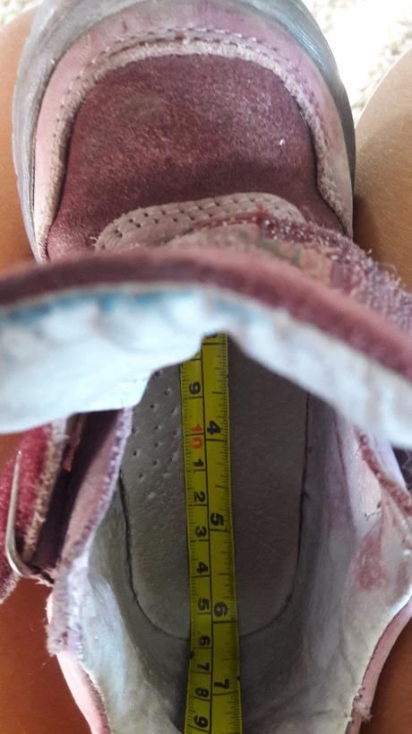 Malo nosene topanky, protetika,24