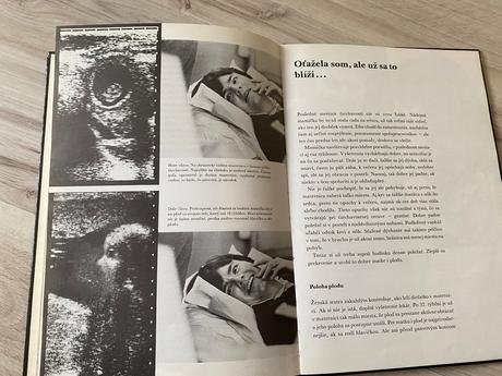 Krásna kniha čakáme dieťatko,