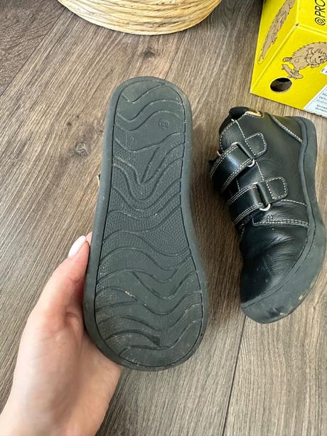 Protetika barefoot prechodné toánočky, protetika,33