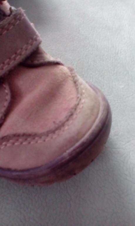 Prechodné topánočky protetika, protetika,22