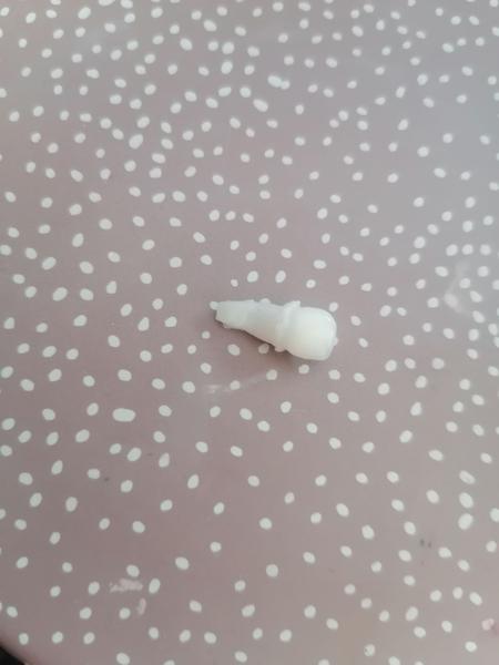 18 mesačná dcéra si vybila predný zub aj s koreňom. Aké máme možnosti jeho náhrady?