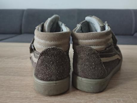 Topanky protetika, protetika,29