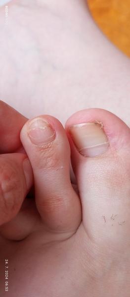 Čo mám robiť s nechtami?