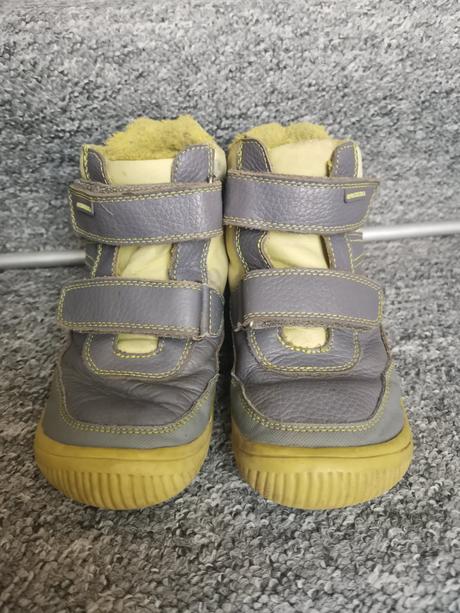 Protetika tyrel 32, protetika,32