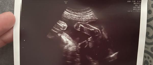 O aké pohlavie ide podľa Vás?