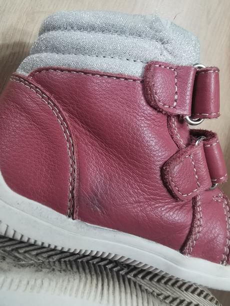 Protetika barefoot, protetika,22