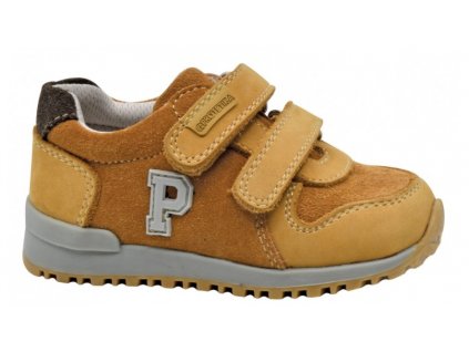 Redly beige protetika prechodne 8, protetika,20 / 21 / 22