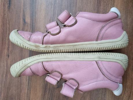 Barefoot topánky protetika, protetika,35