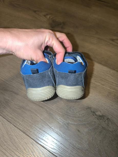 Barefoot sandálky protetika, protetika,27