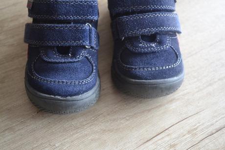 Protetika topánočky, protetika,21