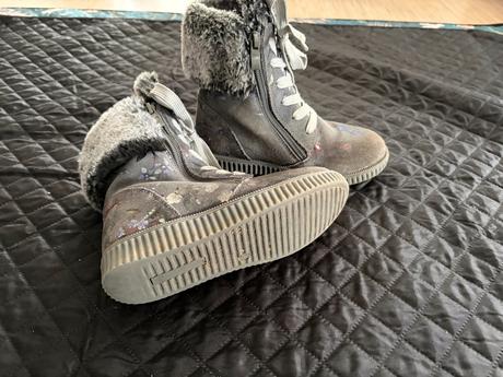 Zimne teplucke protetika topanky, protetika,31