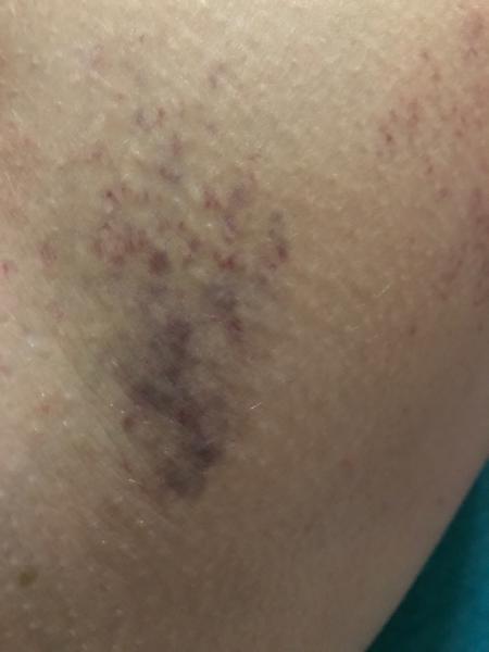 Čo znamenajú tieto škvrny na tele?