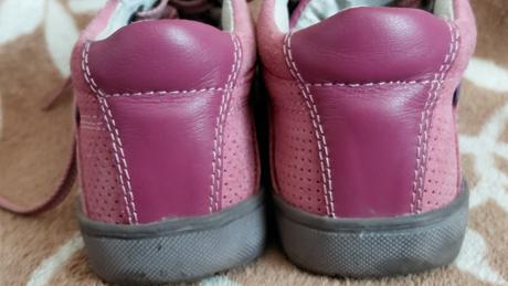 Protetika botičky, protetika,25