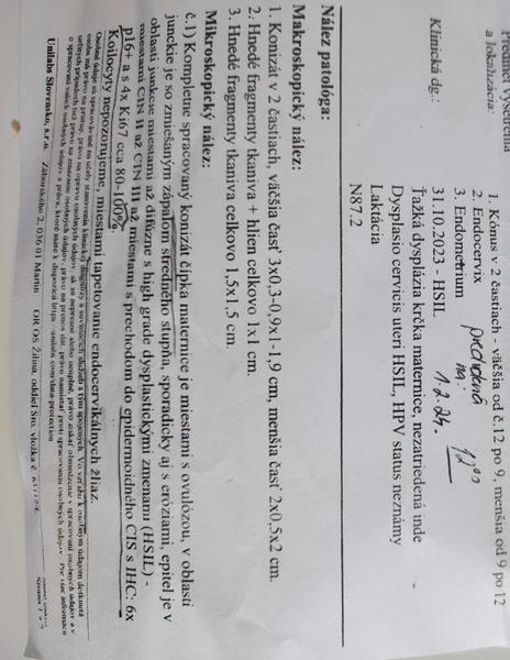 Sú moje výsledky skutočne zlé?