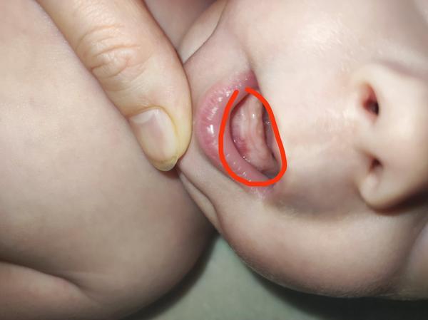 Prerezávajú sa dieťaťu zúbky už v piatich mesiacoch?