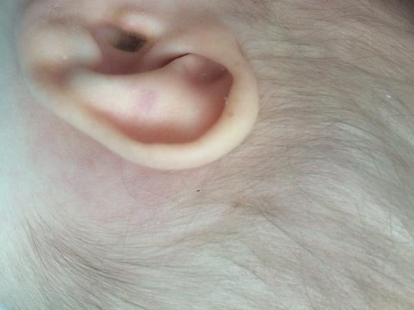 Fliačik na ušku. Čo by to mohlo byť?