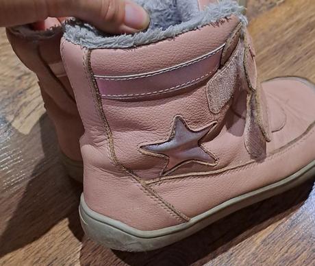 Zimne topanky, protetika,31