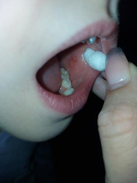 Je to žaba alebo len dohryzené zviera?