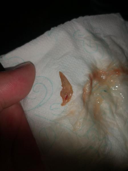 Som na 5 cm otvorená a poslali ma domov