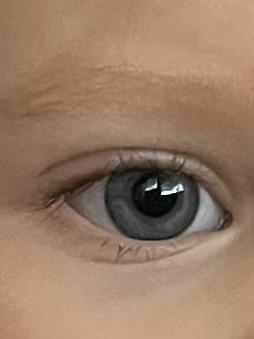 Môže sa meniť farba očí u 16-mesačného dieťaťa?