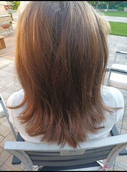 Pripadajú vám vlasy veľmi riedke?