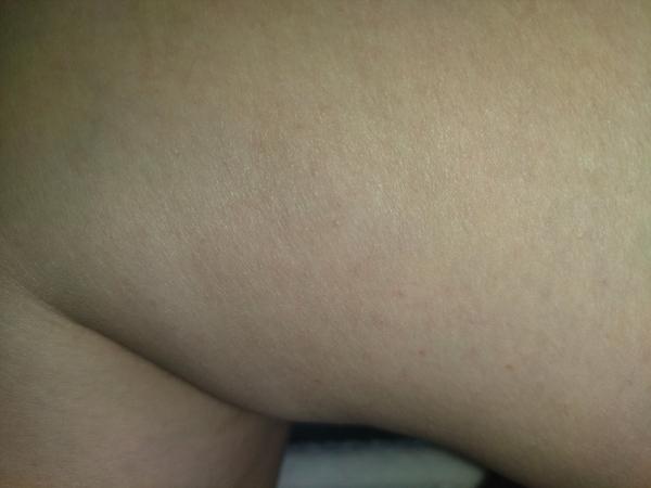 Máte skúsenosti s plošticami a ich štípancami?