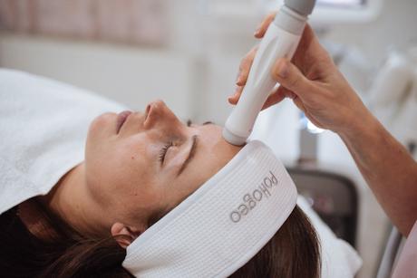 Radiothermolifting - omladenie rádiofrekvenciou, 