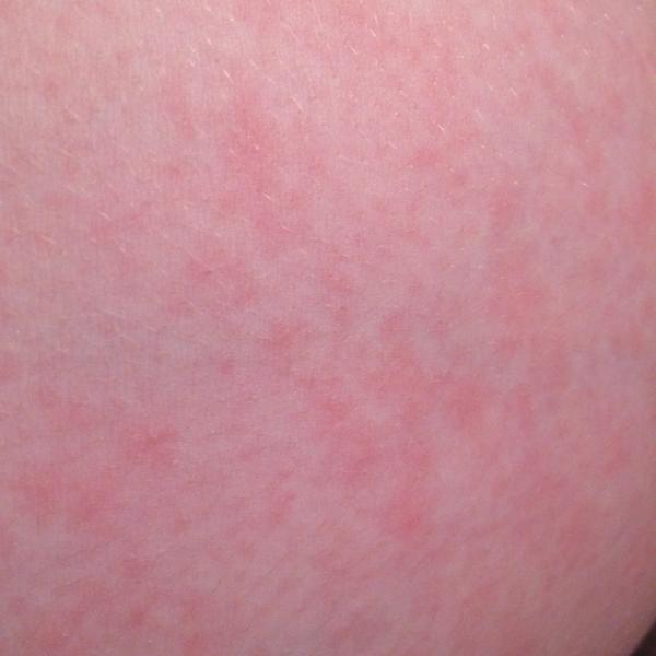 Mali ste niektorá vyhádzané tehotenské bruško?