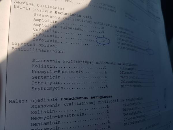 Trojročná dcéra má výtok. Je potrebné preliečenie antibiotikami?