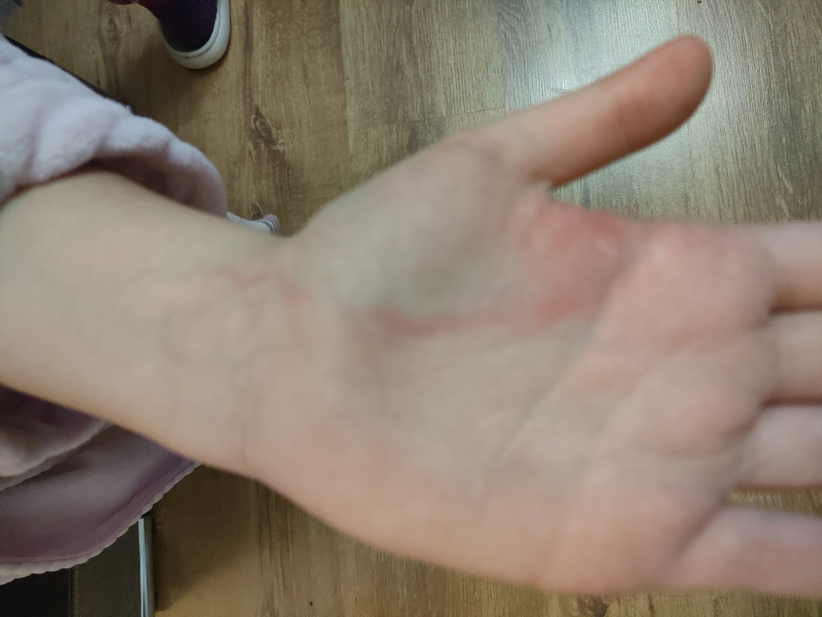 Prečo má dcéra červenú čiaru na ruke? - Modrý koník