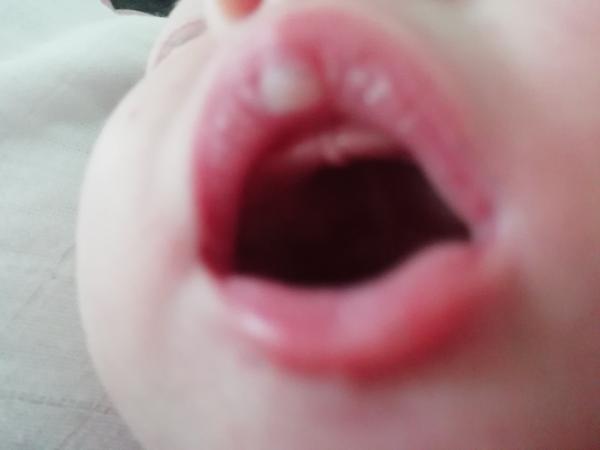 Suché miesto na perách novorodenca