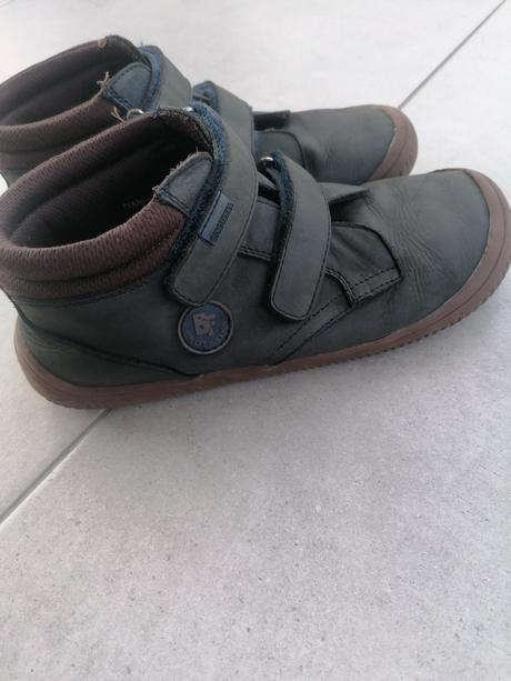 Prechodné protetika, protetika,35