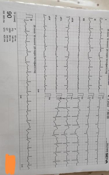 Kto vie zhodnotiť EKG?