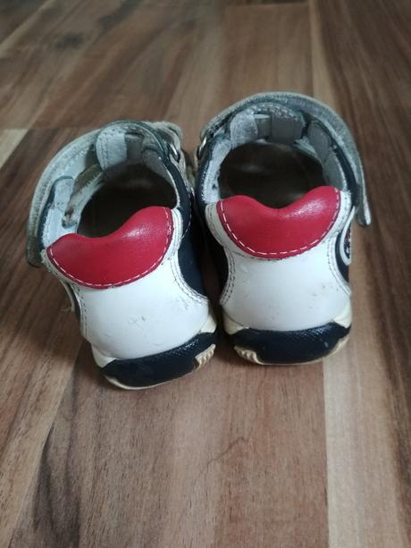 Sandálky protetika, protetika,21