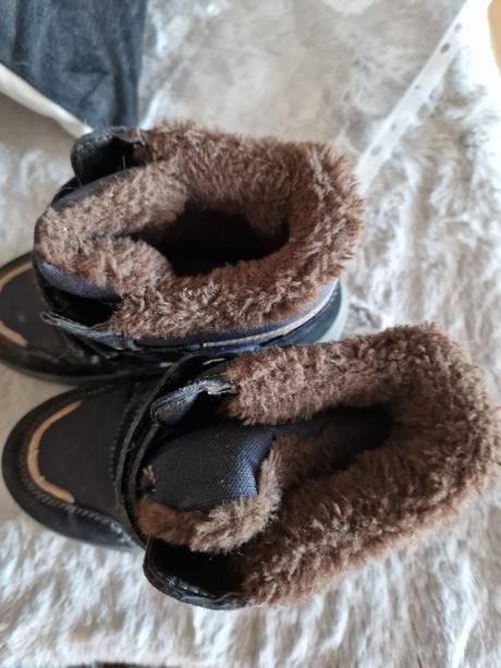 Protetika topanky, protetika,32