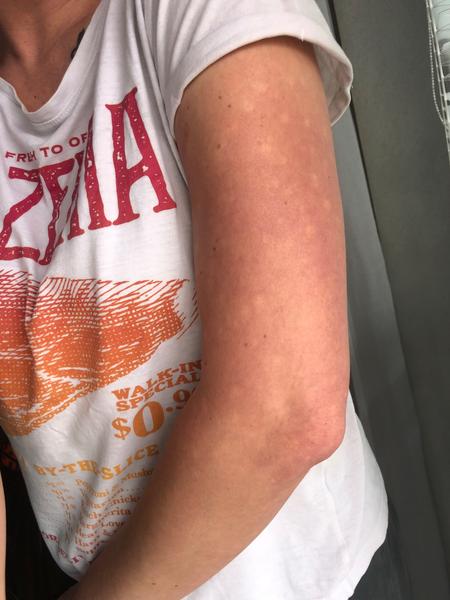 Kde mám hľadať príčinu svojho problému s rukou?