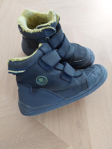 Zimné barefoot, protetika,32