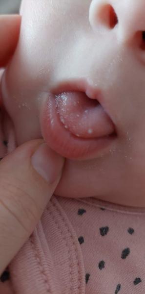 Čo to má dcérka na jazyku po prekonaní Covidu-19?