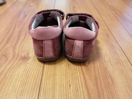 Dievcenske prechodne topanky protetika, protetika,25