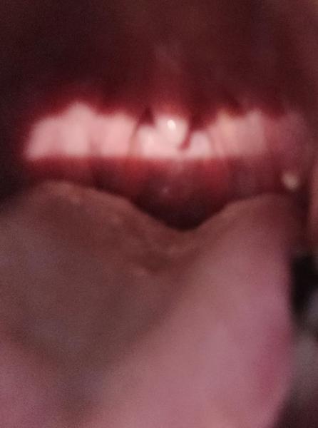 Aký biely vred mám na jazyku?